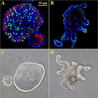 Intestinal in vitro and ex vivo Models to Study Host-Microbiome Interactions and Acute Stressors